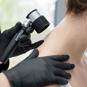 Skin Solution